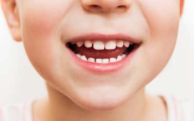 Il fluoro fa bene ai denti. A quelli di tutti, anche dei bambini